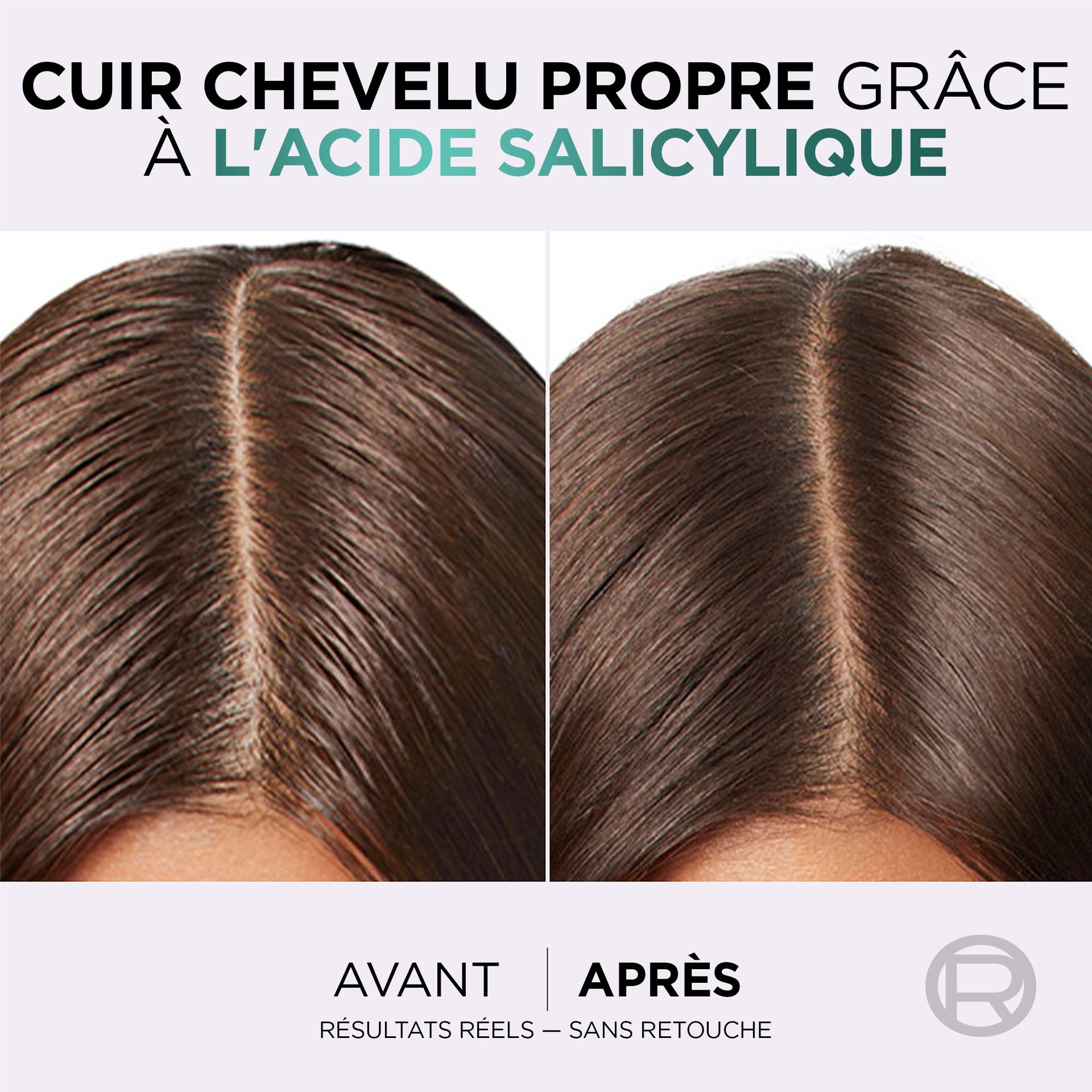 1 femme avant et après l'utilisation du shampoing hyaluron pure avec des racines propres